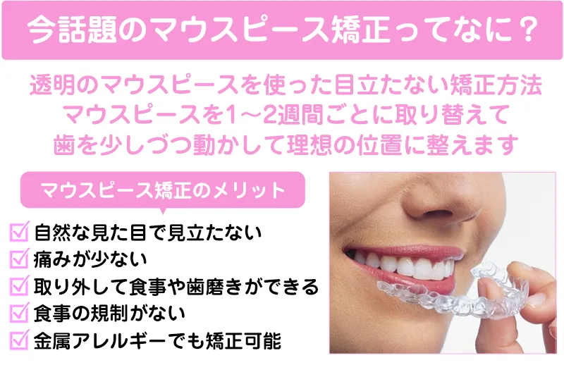 マウスピース矯正とは